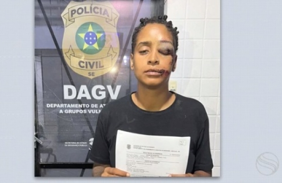 Mulher tem rosto desfigurado durante briga em lanchonete em Aracaju e denuncia homofobia