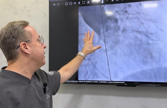 Hospital de Cirurgia realiza procedimento cardiológico inédito pelo SUS em SE